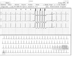 What To Expect From A Good Holter Monitor Reading